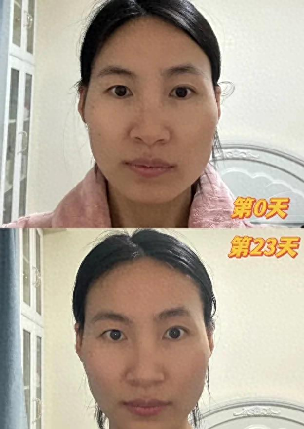 跟练 23 天！筷子操调大小脸，脊柱高低肩也顺了
