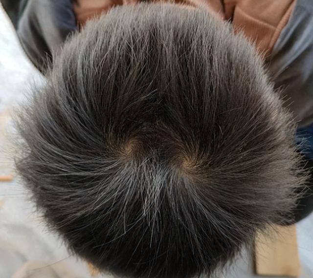 瞎子算命先生的识人术:头上有两个旋的孩子,多半是这两种命,很准