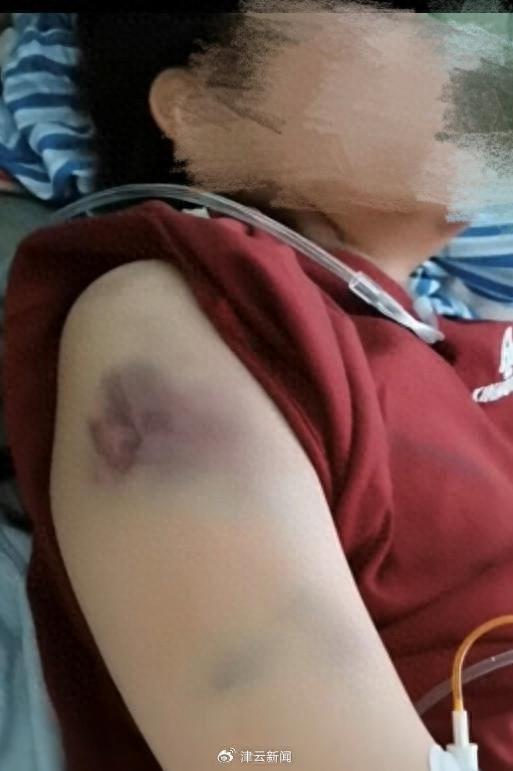 女子遭家暴开车逃跑撞死丈夫 女方父亲：在等二审结果 望判女儿无罪