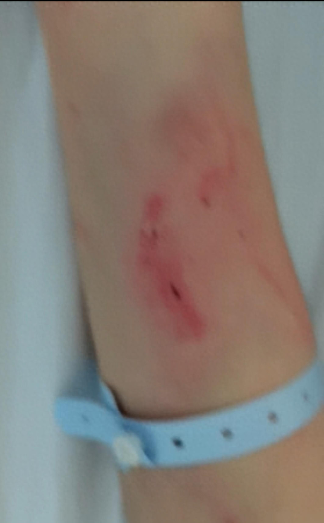 “女子遭家暴驾车逃跑致丈夫身亡案”二审将开庭，其家属坚称系正当防卫