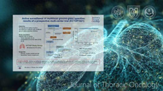 肺部多发磨玻璃结节该如何处理？（最新研究多发性磨玻璃肺结节无需立马开）