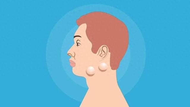 淋巴细胞计数偏高一点正常吗（淋巴结肿大别紧张90是良性的）