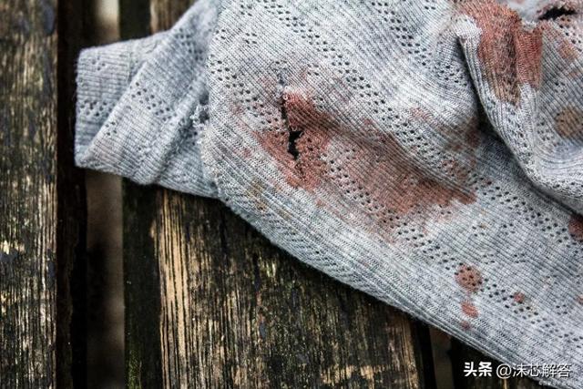 白衣服沾上铁锈怎么洗（告别烦恼教你如何快速去除白色衣服上的铁锈）