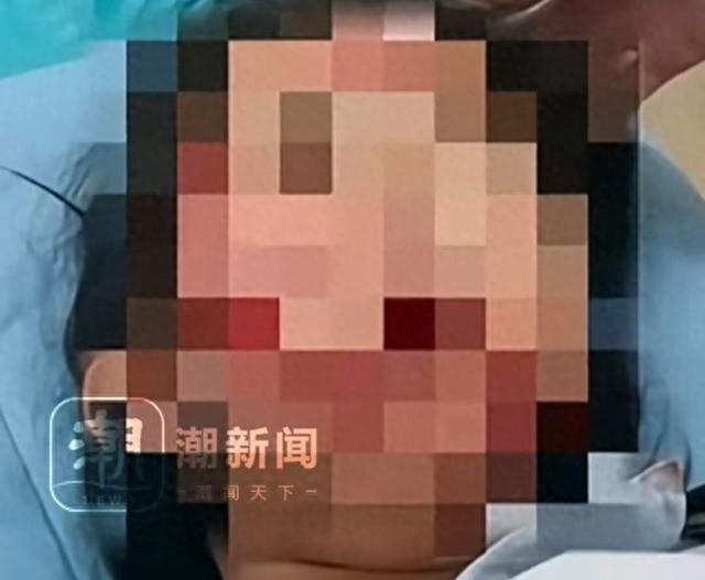 女教师校内驾车撞伤2名小学生，学校：车比较大，可能出现了盲区，目前1名学生已返校，1名学生仍在ICU