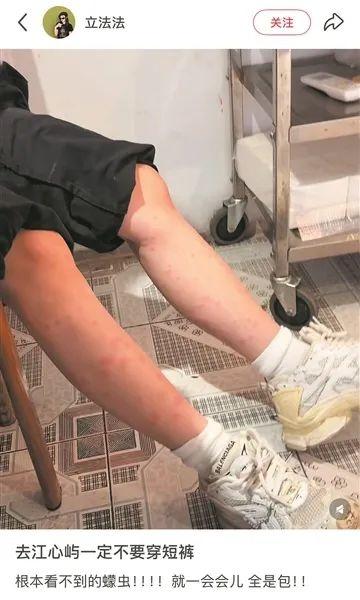 去趟江心屿满腿包？
