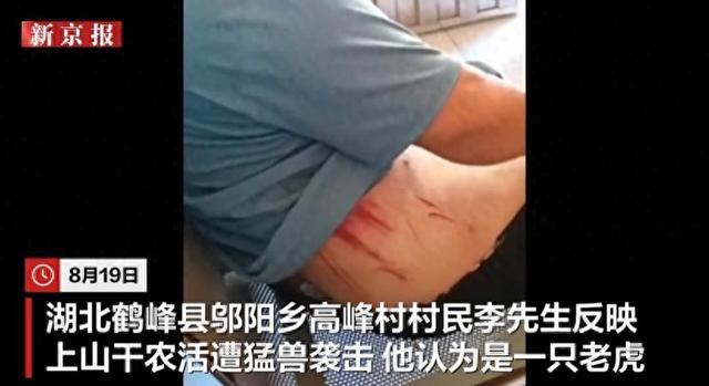 湖北一村民遭大型猫科动物袭击，用锄头砸兽头搏命脱险，当地回应：无老虎分布历史记录，初步推测可能为豹子