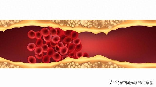 优化锌的功效（血液黏稠别轻视）
