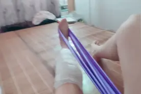 胫骨骨折一年三个月，取钢板术后第八天图片
