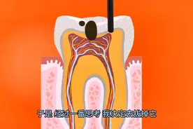 今天拔了尽头牙！#拔牙记图片