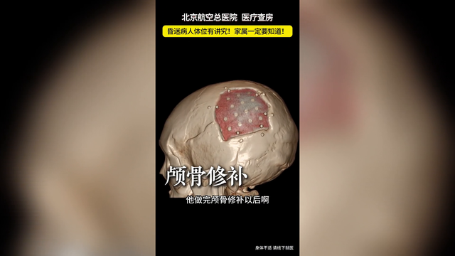 昏迷病人体位有讲究！家属一定要知道！