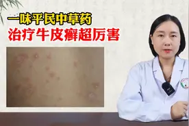 一味“平民中草药”，治疗牛皮癣超厉害图片