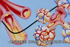 磁共振（MRI）检查前需要做什么准备图片