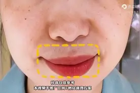 唇周长斑，可能是宫寒！图片