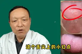 舌苔红点多，就是阴虚火旺吗？错，还有这两种体质图片