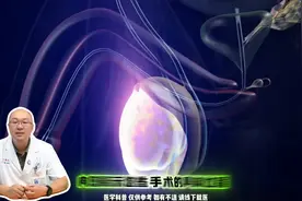 男性输精管结扎到复通，仅需一个创可贴就能完成的微创精准...图片