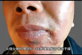 六神丸#六神丸图片