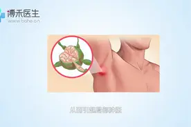 胳肢窝长了一个小肉粒是怎么回事图片