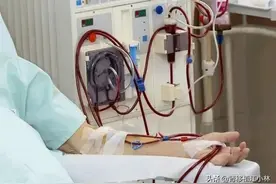 你所知道做过肾移植的患者存活多久？图片