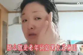 老年斑激光术后怎样修复？通过最简单省钱的方法，让痕迹消失图片