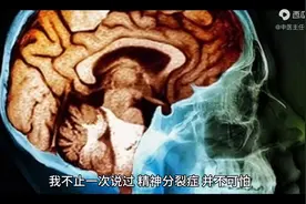 精神分裂，学会用桂圆，补脾、养血、安神，幻听不再扰图片
