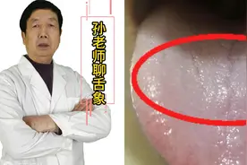 万病不离湿，痰湿体质的人舌象都有什么特点？一分钟学会看舌象图片
