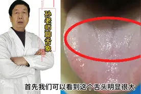 万病不离湿，痰湿体质的人舌象都有什么特点？一分钟学会看舌象图片