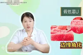 3点教你区分真假湿疣！图片