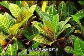 你知道人体受到核辐射后会产生什么变化吗？图片
