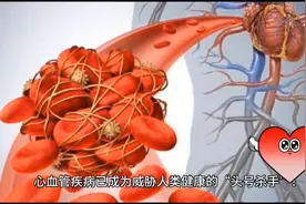 心脏发出的5个求救信号!预示即将发生心梗!千万别忽视!...图片