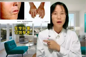 皮肤变硬是一种病，它的名字叫硬皮病#医学科普图片