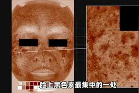 智商税？难道想要变白真的没希望了？#皮肤管理图片