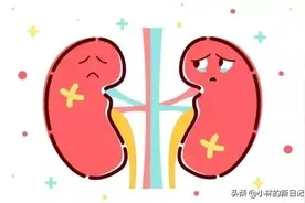 肾衰竭靠透析可以维持多久？后期的治疗花费怎么样呢？图片