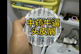 大女儿头皮屑多，头发痒，去医院开了点中药#脂溢性皮炎图片