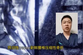腰椎压缩性骨折判断新鲜还是陈旧图片