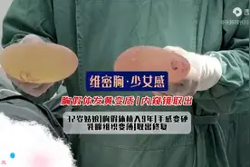 32岁姑娘，胸假体植入9年，手感变硬，乳腺组织变薄，取出修复图片