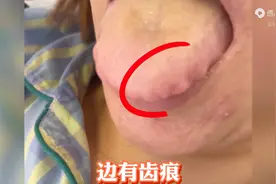舌苔白腻 有齿痕 脾虚 湿气重 送你两味汤图片