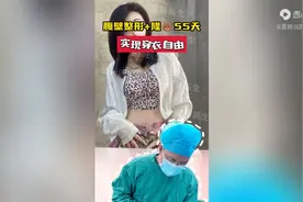 腹壁成形55天，记录一下！图片