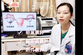 卵巢囊肿、输卵管囊肿、附件囊肿，这三者是这么一回事图片