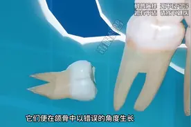 牙齿冷知识：乳牙、智齿和鼻牙图片
