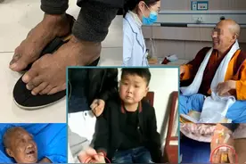 什么坏习惯会导致痛风？图片