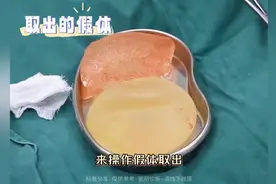 宝妈10年的胸假体终于取出来，换脂肪丰胸，打造出深V乳沟图片