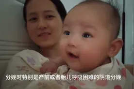 盆底肌修复到底是不是智商税？图片