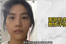 亲测有效！3个动作改善面部不对称，拯救高低眉/高低眼/...图片