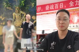 植发20多天后，我彻底秃了……#植发#脱发#米诺地尔图片