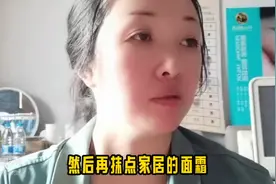 谁能想到！这么简单就能轻松改善口周暗黄，还能顺便提升法令纹图片