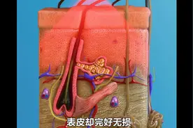 激光脱毛原理有多简单？慢镜头下才能发现，竟然如此奇妙图片