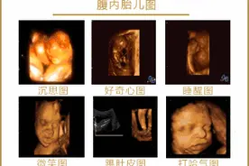 为什么肚中的胎儿有时候总动，有时却一天也不怎么动？图片