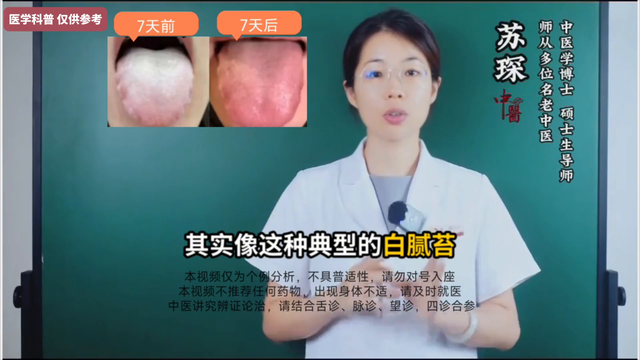 2 味药，专克白腻苔，仅7天，白腻苔消得干干净净