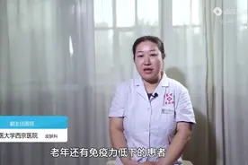 最疼的皮肤病——带状疱疹是怎么被传染的？医生：这1点很关键图片