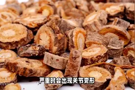 类风湿，两味药，赶走体内的风、寒、湿图片